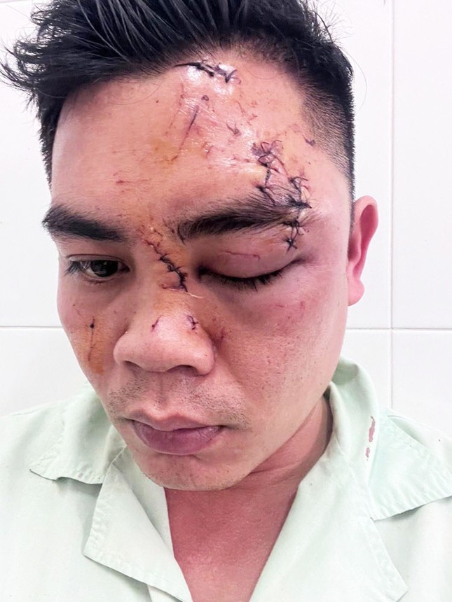 Ba cháu bé gào khóc, cầu cứu khi người cha bất ngờ bị đánh dã man tại nhà hàng ảnh 2