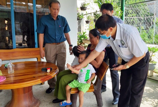 Lâm Đồng: Liên tiếp 4 trường học bùng phát bệnh tay chân miệng ảnh 1