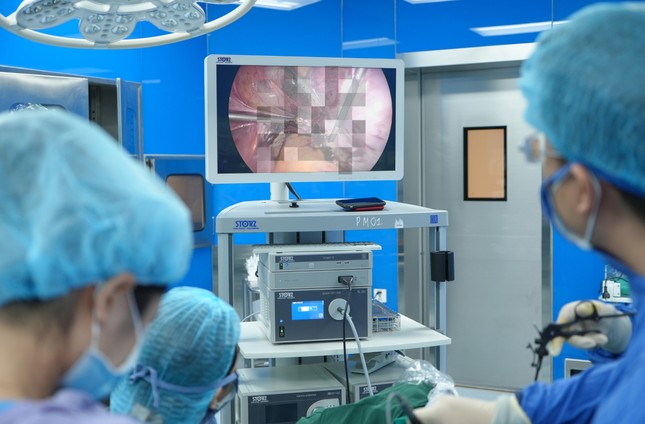 Đi khám dạ dày, bé gái 13 tuổi vô tình phát hiện u nang buồng trứng ảnh 2