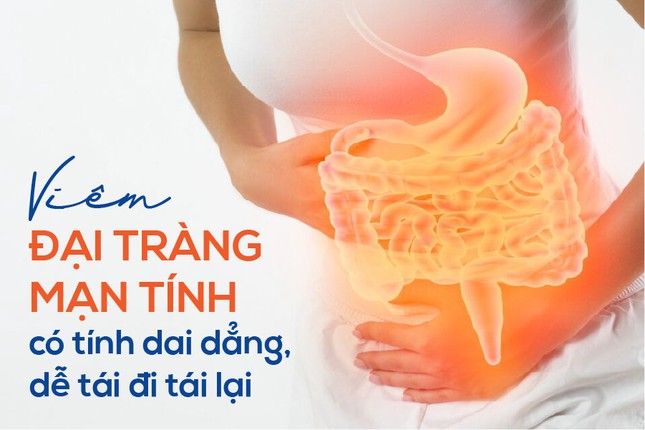 Đây là lý do vì sao viêm đại tràng đeo bám bạn dai dẳng! ảnh 1