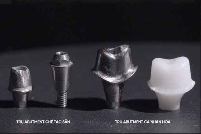 Tầm quan trọng của trụ phục hình cá nhân hoá trong cấy ghép implant ảnh 1