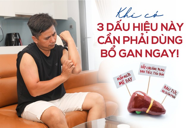 Bổ gan, giải độc gan ngay nếu cơ thể xuất hiện 3 dấu hiệu này ảnh 1