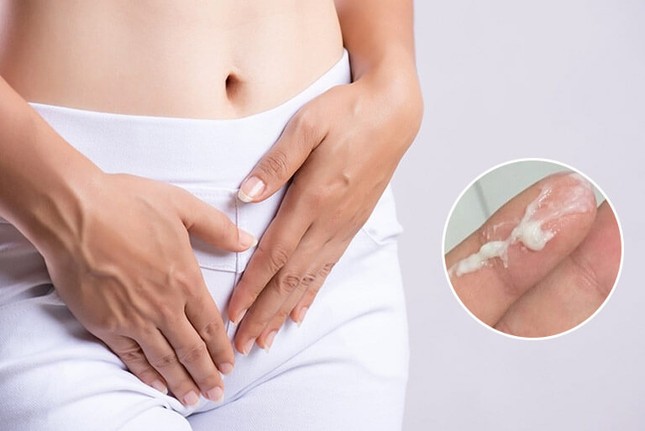 Cảnh báo: Viêm phụ khoa - Nguy hiểm tiềm ẩn và giải pháp điều trị dứt điểm tại Sinclair ảnh 2