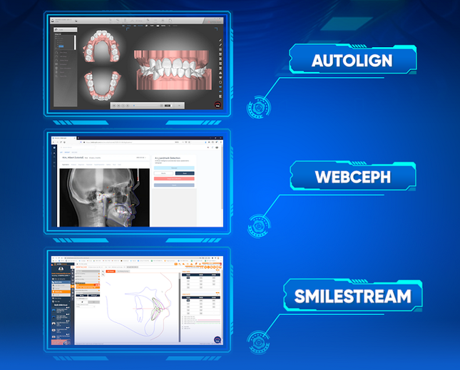 Răng lung lay bất thường khi niềng: Cảnh giác với các biến chứng nguy hiểm! ảnh 3
