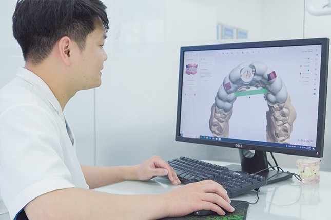 Bí quyết thành công của công nghệ trồng răng implant DCT ảnh 2