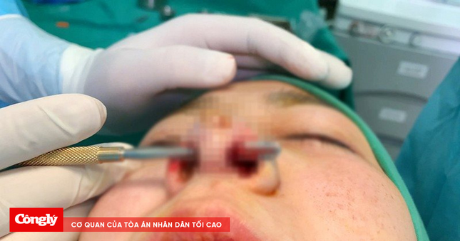Phẫu thuật thẩm mỹ theo trào lưu: Chứng tỏ đẳng cấp hay tiền mất tật mang? ảnh 1