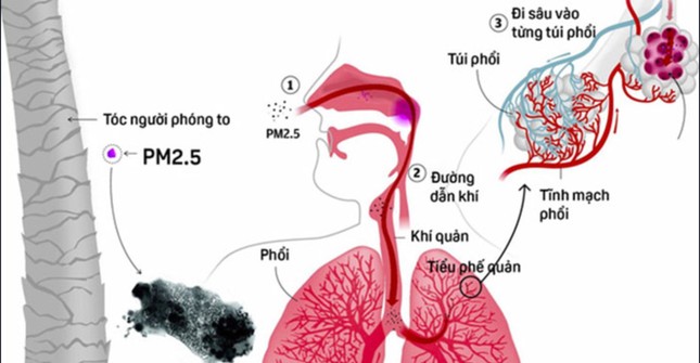 Làm sao để bảo vệ 'cửa ngõ' hô hấp? ảnh 1