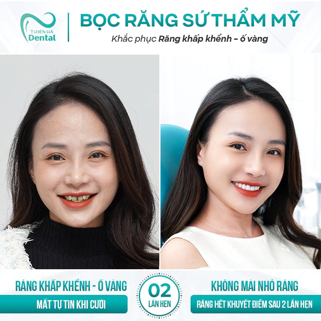 Nha khoa Thiên Hà - Địa chỉ bọc răng sứ uy tín, kiến tạo nụ cười rạng rỡ ảnh 3