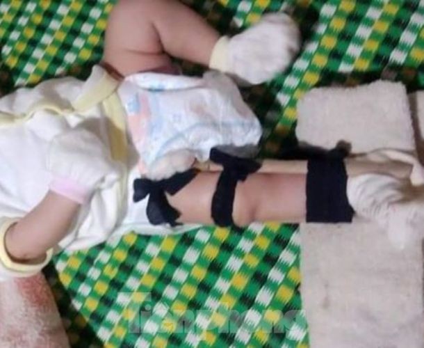 Thực hư cha đạp gãy chân bé sơ sinh vì 'quấy khóc' ảnh 1