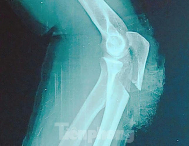 Nghĩ hàng xóm tụ tập nói xấu mình, thanh niên vác dao qua chém loạn xạ ảnh 2