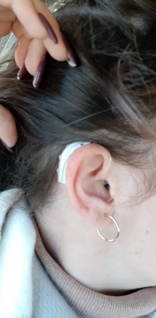 Cứ tưởng dầu gội chảy vào làm đau tai, nhưng cô gái này bỗng nhiên không nghe thấy gì nữa ảnh 1