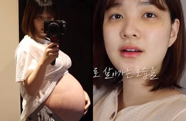 Bí quyết giảm 30kg của “bà mẹ trẻ nhất K-Pop”: Tưởng không dễ mà dễ không tưởng ảnh 2