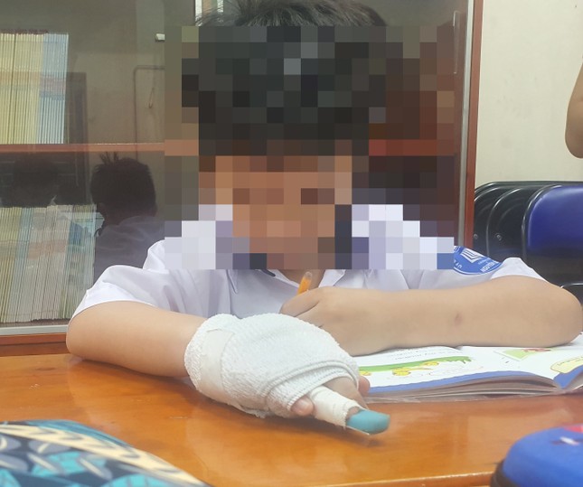 Tạm đình chỉ giáo viên đánh gãy ngón tay học sinh ảnh 2