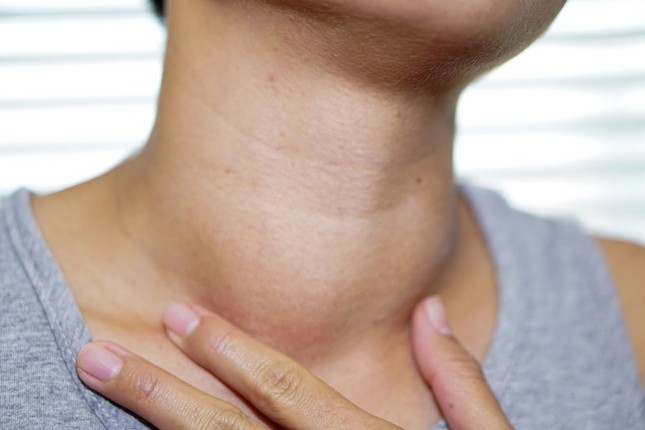 Bướu lành tính hóa ung thư vì người bệnh chủ quan ảnh 1