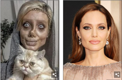 Kinh hãi dung nhan cô gái phẫu thuật 50 lần để giống Angelina Jolie ảnh 6