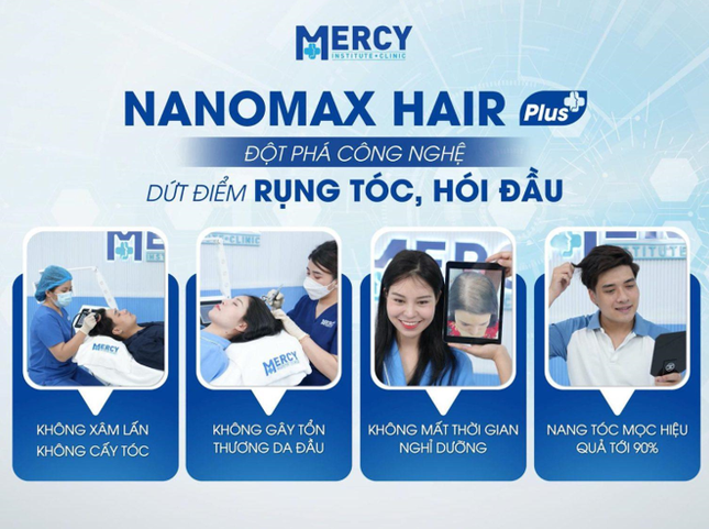 Trị rụng tóc hói đầu Nanomax Hair Plus giá bao nhiêu? ảnh 3