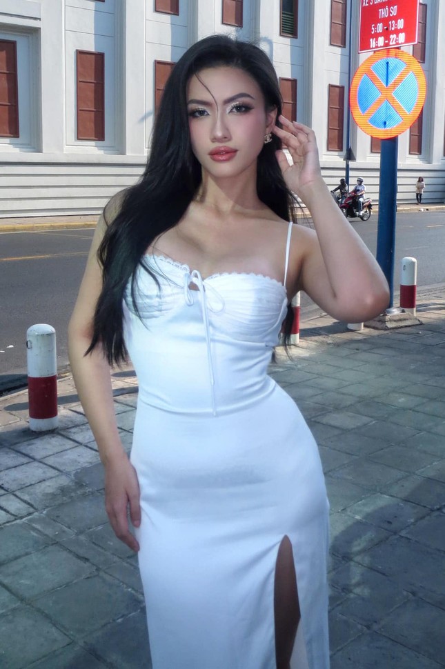 Á hậu Minh Nhàn khác lạ không nhận ra sau khi công khai phẫu thuật thẩm mỹ ảnh 2