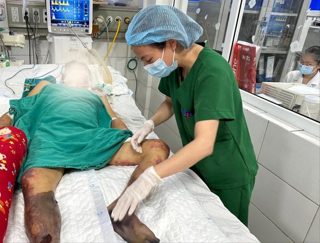 Cảnh giác với thực phẩm độc hại dịp Tết ảnh 1