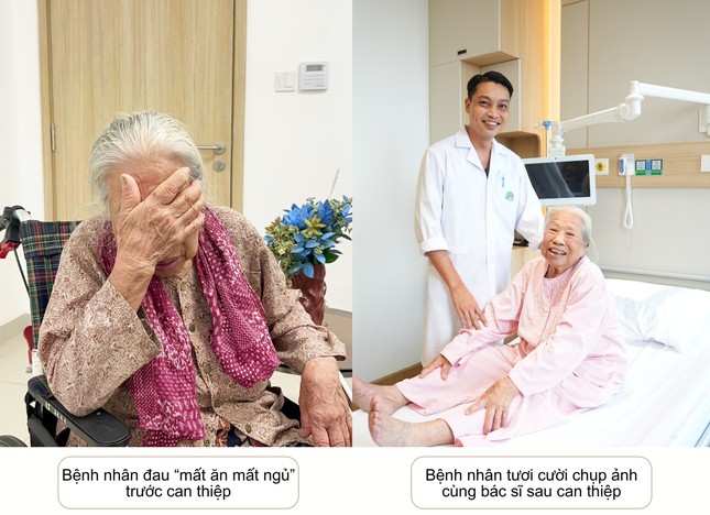 Chấm dứt đau dây thần kinh số 5 hành hạ cụ bà 90 tuổi bằng kỹ thuật xâm lấn tối thiểu ảnh 1