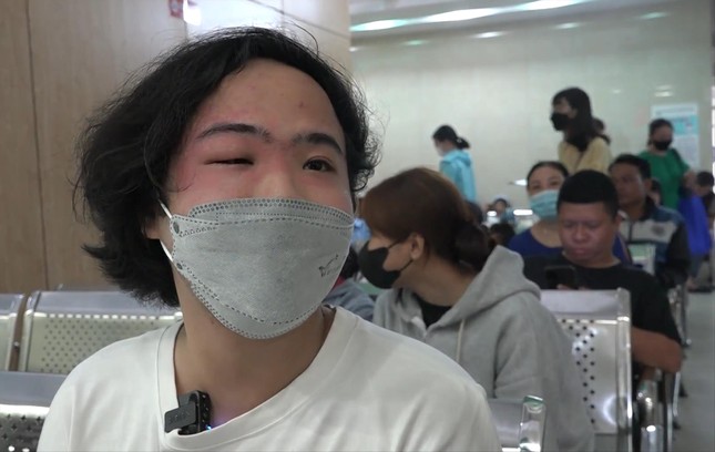 Hàng loạt bệnh nhân nhiễm độc kiến ba khoang ở TPHCM ảnh 1