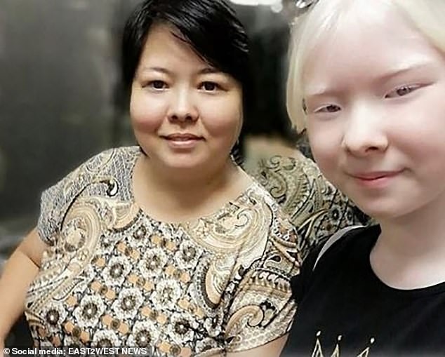 Diện mạo khác lạ của hai chị em người Kazakhstan bị bạch tạng gây 'sốt' ảnh 8