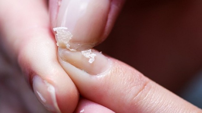 Tự dưng đau nhức, mất ngủ, mệt mỏi, có thể bạn đang thiếu canxi trầm trọng ảnh 2