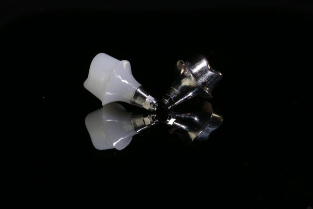 Giắt thức ăn sau khi trồng răng implant - Bài toán đã có lời giải ảnh 2