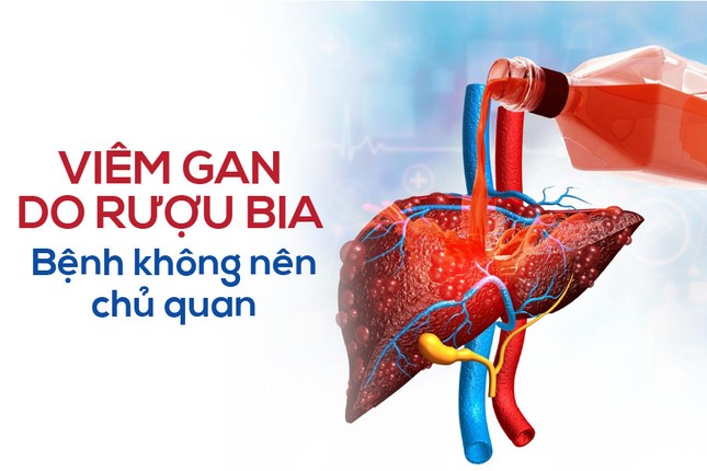 Viêm gan do rượu có phải bệnh lý nguy hiểm không? ảnh 1