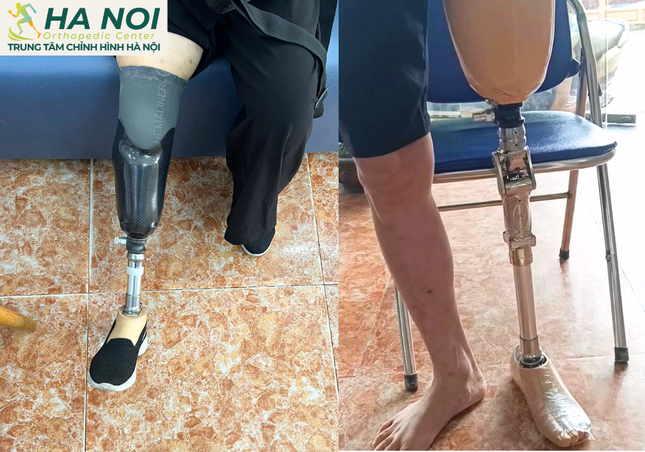 Trung tâm chỉnh hình Hà Nội: Niềm hy vọng cho những bệnh nhân khuyết tật ảnh 2