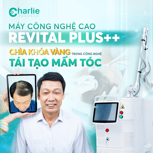 Phòng khám Charlie tạo bước đột phá với xu hướng thon gọn hàm không xâm lấn ảnh 3