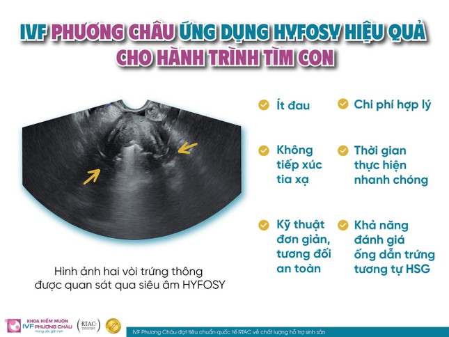 Kiểm tra tử cung – vòi trứng: Phương pháp hiệu quả và an toàn ảnh 2