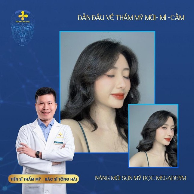Trẻ lâu hơn với dịch vụ nâng mũi độc quyền ở Thẩm mỹ Như Hoa ảnh 1