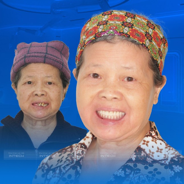 Mỗi ngày tiết kiệm 100k để đưa mẹ đi trồng răng ảnh 3