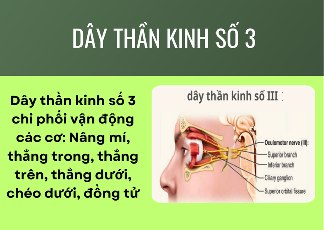 Tại sao liệt dây thần kinh số 3 gây sụp mí mắt? ảnh 1