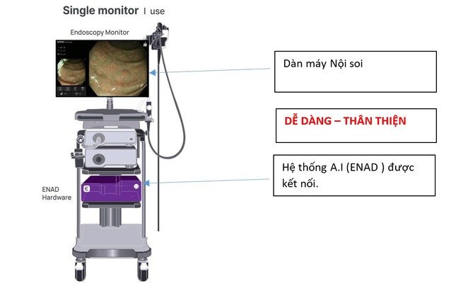 Những khả năng phi thường của A.I trong nội soi tiêu hóa ảnh 1