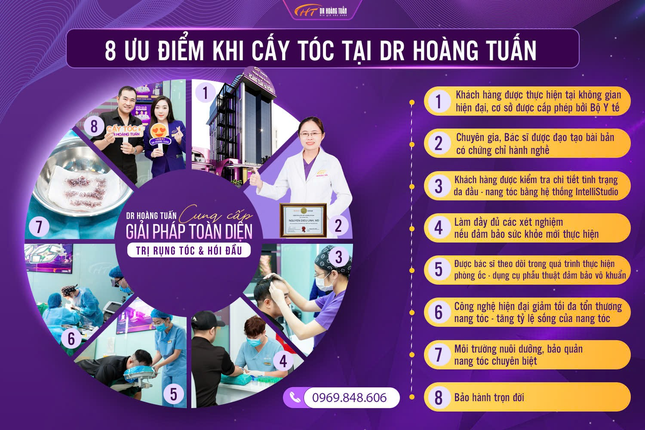 Ca sĩ Minh Quân chia sẻ trải nghiệm khi lựa chọn cấy tóc tự thân ảnh 3