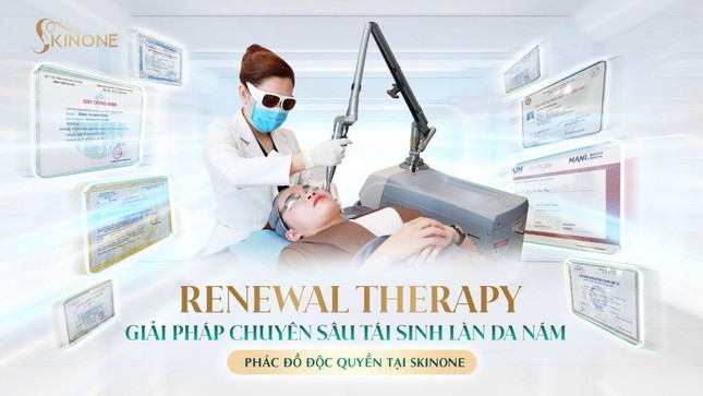 SkinOne: Dẫn đầu xu hướng tái tạo phục hồi làn da nám ảnh 1