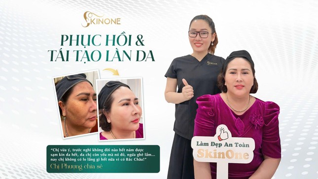 SkinOne: Dẫn đầu xu hướng tái tạo phục hồi làn da nám ảnh 2