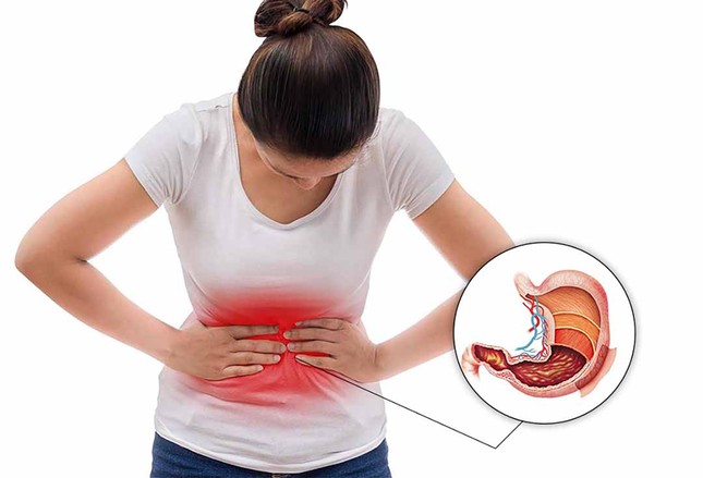 Những thói quen sai lầm có thể khiến dạ dày của bạn bị ăn mòn, viêm loét, gây đau đớn ảnh 1