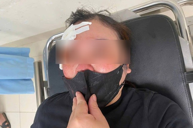 Hà Nội: Một phụ nữ tố bị người đi ô tô dùng dùi cui đập vào đầu vì không tránh đường ảnh 1