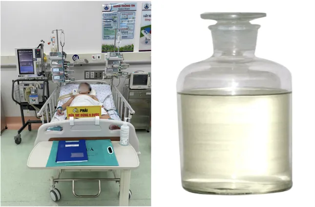 Hít phải khí kịch độc trong xe hơi, bé trai nguy kịch ảnh 1