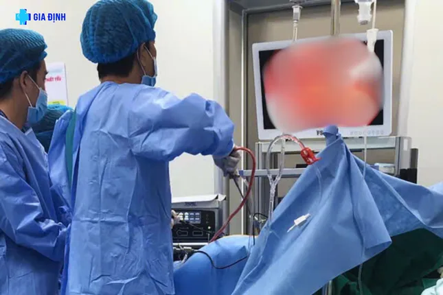 Bác sĩ Thái Lan bị thủng túi mật được các bác sĩ Việt Nam cứu sống ảnh 1