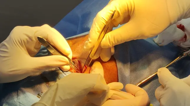 Cứu người đàn ông bị hàng xóm dùng đũa đâm xuyên hốc mắt ảnh 2