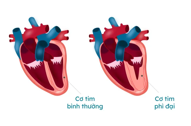 Đang khỏe mạnh, nam thanh niên bỗng ngất xỉu rơi vào tình trạng đột tử tim mạch ảnh 2