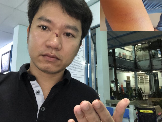 Người dân 'tố' bị người lạ hành hung khi làm việc với CSGT Hàng Xanh ảnh 2