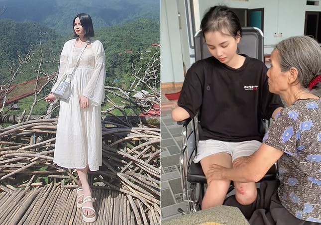 Cô gái Phú Thọ mất tứ chi trong một tháng, được mẹ chăm như trẻ sơ sinh ảnh 1