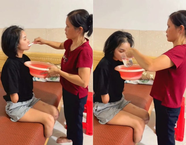 Cô gái Phú Thọ mất tứ chi trong một tháng, được mẹ chăm như trẻ sơ sinh ảnh 2