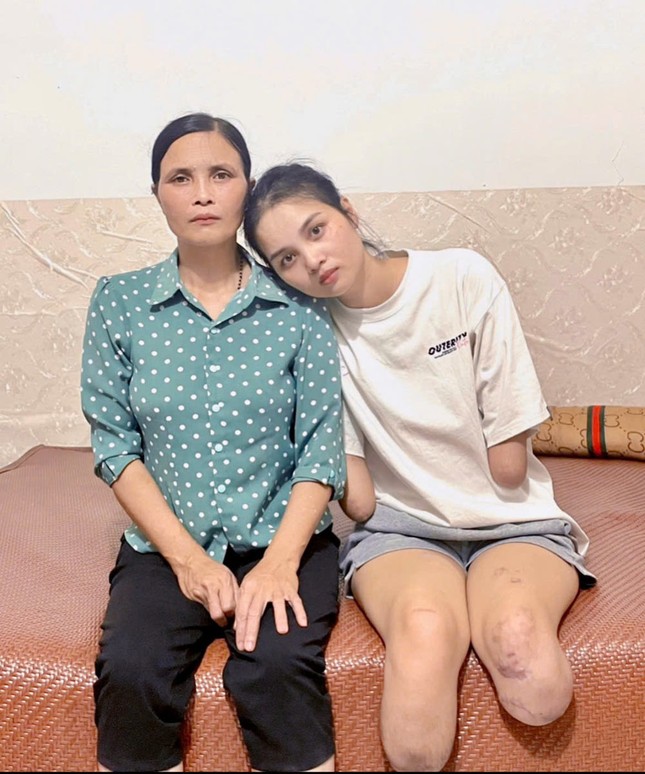 Cô gái Phú Thọ mất tứ chi trong một tháng, được mẹ chăm như trẻ sơ sinh ảnh 4