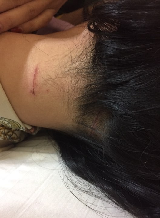 Tạm giữ cựu cán bộ công an đánh vợ cũ dã man ảnh 2