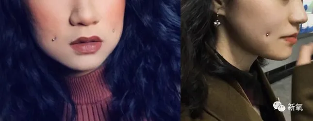 Cô gái trẻ 17 đóng đinh vào má để có má lúm đồng tiền như diễn viên Lê Tư ảnh 1